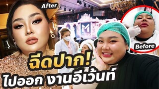 แอบตื่นเต้นนะ ลงทุน"ฉีดปาก"เพื่อไปออกอีเว้นท์ ฟิวดาราง่ะแก | จือปาก