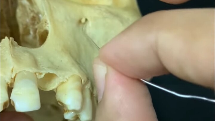 The two small openings located above and below your eye sockets serve as pathways for nerves and blo