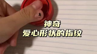比别人多一个拇指，盖个指纹竟然成了爱心的形状，把视频分享给你想要比心的人吧。 比心 爱心 爱你 六指