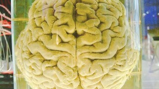 สมองยังคงมีสติอยู่หลังความตาย