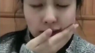 白鹿拔智齿的前后对比