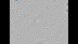 Teaching cell biology with live-cell imaging: contamination in a HeLa cell culture | CytoSMART Lux2