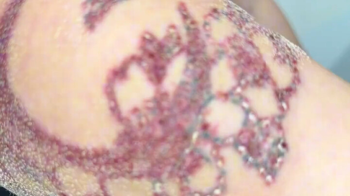 Cô gái ngọt ngào tràn đầy năng lượng tẩy sạch bốn hình xăm, đôi mắt cười như mang theo ánh sao.