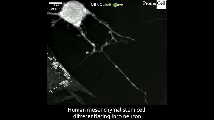 Label-free live cell imaging of differentiation of umbilical cord matrix human MSCs into neurons