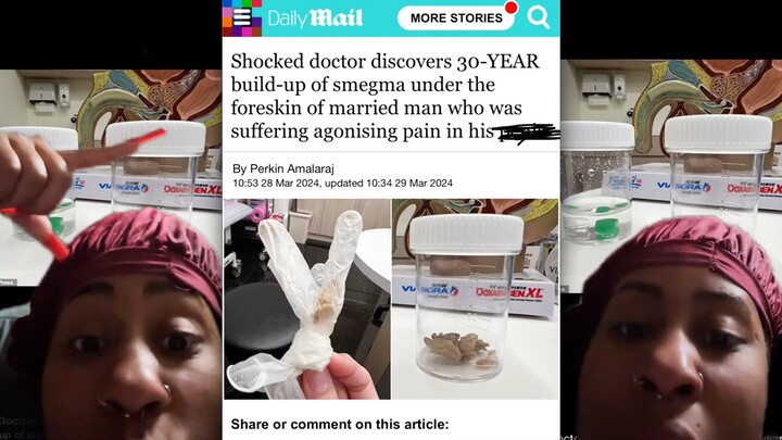 Tak bisa berkata apa-apa‼ ️30 tahun smegma‼ ️