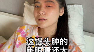 当你有一个特别招蚊子的女朋友 你就安全了