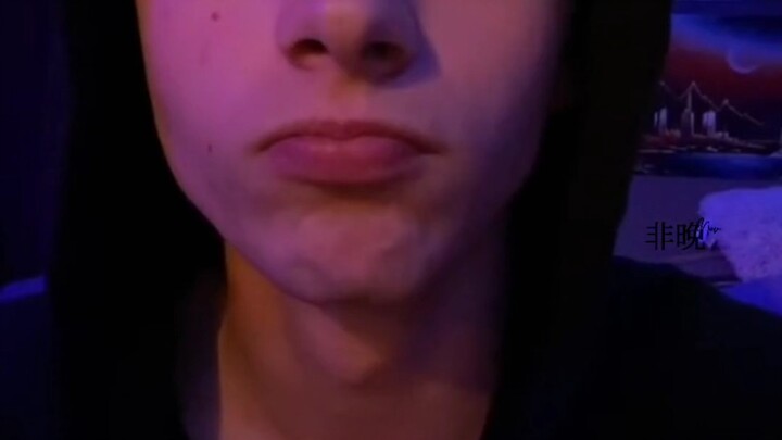 เมื่อไลน์ผมสูงเกินไปจนต้องไว้หน้าม้า...