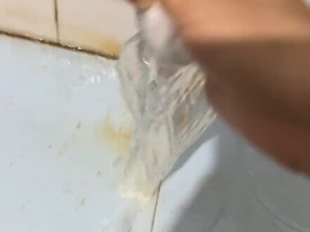 The water quality at school is no wonder I get acne on my face