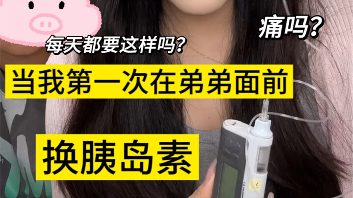 Cô gái mắc tiểu đường tuýp 1 lần đầu tiên thay insulin trước mặt em trai, thế mà em trai lại hỏi…
