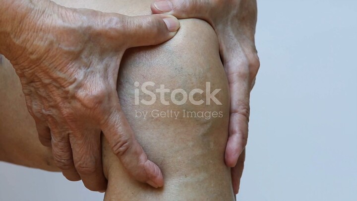 Artizynt Kaufen – Mehr Lebensqualität durch gesunde Gelenkfunktion [Artizynt Ergebnisse]