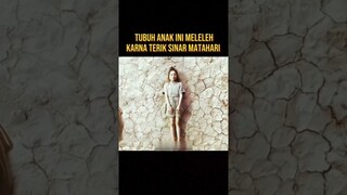 TUBUH ANAK INI MELEH KARNA TERIK SINAR MATAHARI #alurceritafilm #film