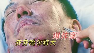 【ลุงถัง】เรื่องจริงจากชีวิตจริง: ใช้สะเก็ดระเบิด 100 ชิ้นทั่วร่างกายแลกกับความสงบสุขของเมืองหนึ่ง ยูซ