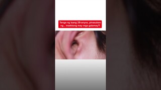 Tenga ng isang 29-anyos, pinasukan ng insektong may mga galamay?! | Kapuso Mo, Jessica Soho