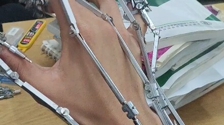 الإصدار الثاني من ذراعات الفرجار، الجيل الثاني!