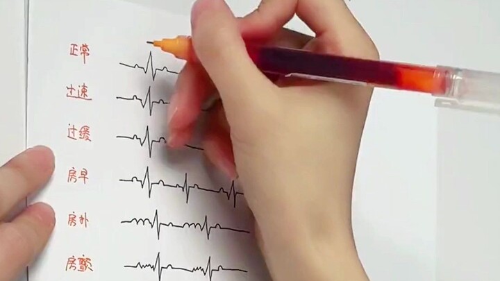 Làm thế nào để đọc kết quả điện tâm đồ bất thường?