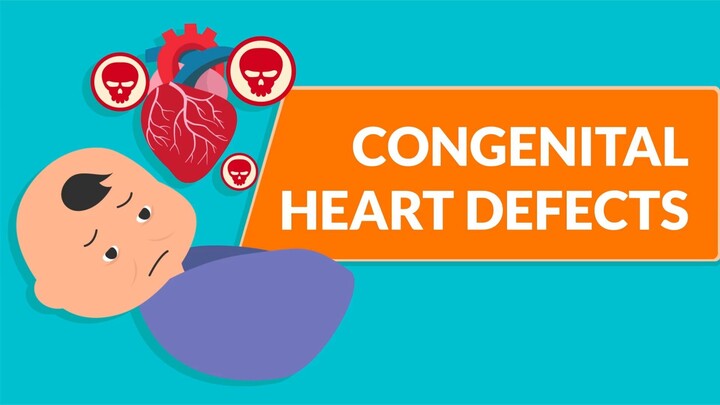 Congenital Heart Defects - Full Video