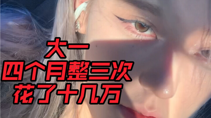 أنا في السنة الأولى من الجامعة، أجريت العملية ثلاث مرات خلال أربعة أشهر، وأنفقت أكثر من مئة ألف.