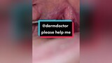 Please send this to  dermdoctor drshah duet reviewphimhay
