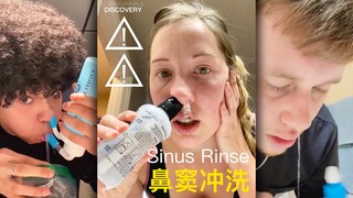「鼻窦冲洗」：过敏或鼻部手术后会推荐的一项治疗