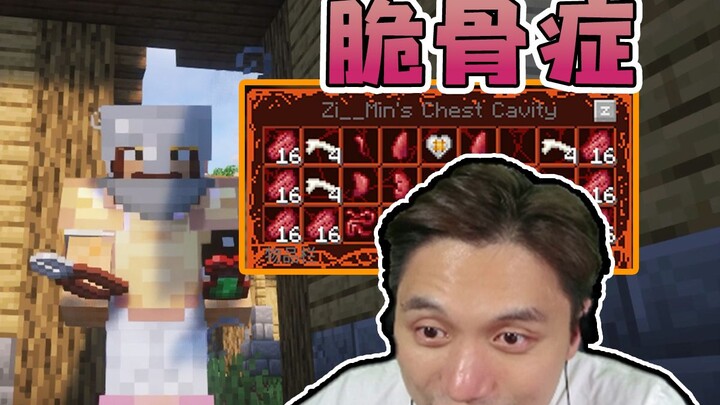มายคราฟ แพ็กเกจทดลองเอาตัวรอดโรคกระดูกเปราะ