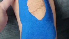 Kegunaan Kinesiology Tape