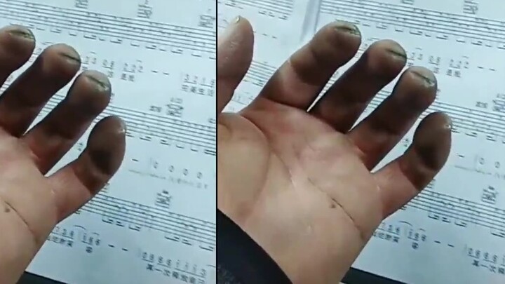 Playing the guitar is not as easy as you think, just look at their hands and you will know how hard 