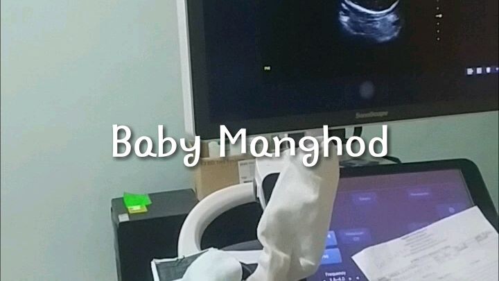 32 WEEKS BABY - ULTRASOUND MONITOR