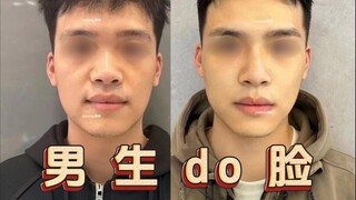 ผู้ชายทำศัลยกรรมใบหน้าต้องใช้เงินเท่าไหร่