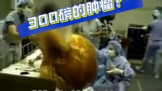 Seperti apa jadinya jika tumor ovarium seberat 270 pon diangkat?
